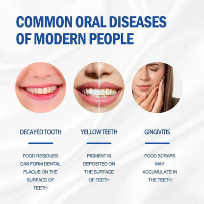 Sp-4 probiotic whitening toothpaste, Teeth Whitener Toothpaste, Natural Tooth Whitener